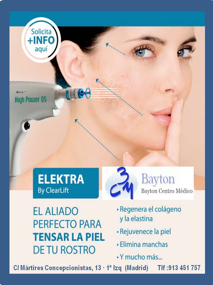 Tratamiento-Laser-Electra-Clínica-Bayton