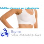 Celulitis-en-brazos-clinica-bayton-tratamientos